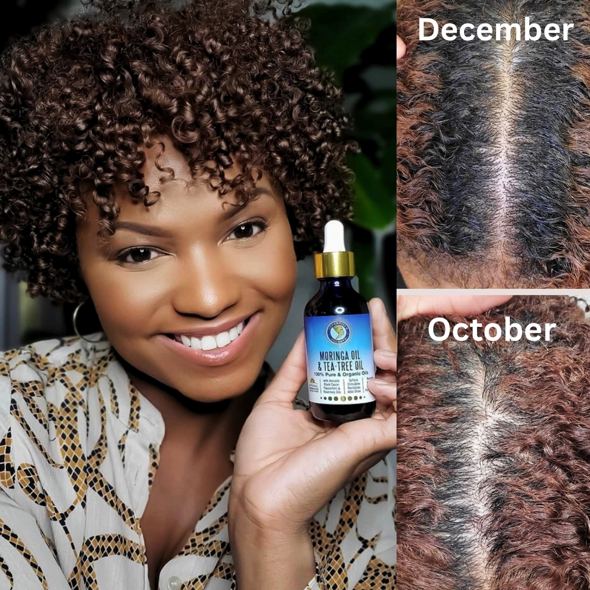 Founder’s Hair Growth Bundle